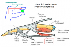 Flexion of the metacarpophalangeal joints, extension of the interphalangeal joints.