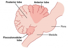 Anterior, posterior, and flocculonodular