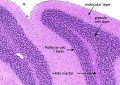 Molecular layer (few cells) --> Purkinje cells --> Granular layer (many cells)