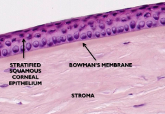 Located between superficial epithelium and stroma. Strong collagen fibers help the cornea keep its shape.