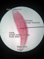 - Phylum Porifera
- Class Calcarea 
- Scypha (aka Granita)
- Syconoid (body wall is folded)
     • Spicules extend through the body wall
     • Dermal ostia dotting body
     • Basal disc at bottom, apical osculum at top