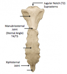 1. Suprasternal jugular notch (TII)
2. Sternal angle (TIV-V)
3. Xiphisternal

							junction (TIX)