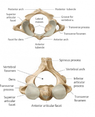 Cervical (C1-C7): 
• Bifid spinous process, transverse foramen, kidneyshaped vertebral foramen with a SMALL body 
• C1 (Atlas): lack body and spinous process 
o 2 ATLANTO-OCCIPITAL JOINTS – “YES”nodding 
• C2 (Axis): contains DENS (odo...