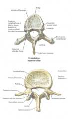 (T1-T12): 
• Costal facets: vertebral body +transverse process – formCOSTOVERTEBRAL andCOSTOTRANSVERSE jointsLumbar 


(L1-L5): 
• LARGE body with blunt spinousprocess