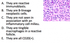 B-lineage neoplastic cells