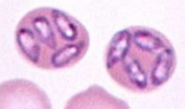 Identify the protozoal parasite that appears single or multiple pear shaped within the RBC.