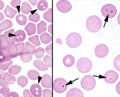 Identify the protozoal parasites indicated by the arrows.