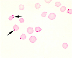 Identify the protozoal parasites indicated by the arrows.