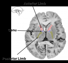 The anterior limb, genu, & posterior limb, are all part of what?