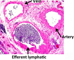 - Vein: thin walled
- Artery: thicker walled
- Efferent Lymphatic: relatively thin walled wiht many cells in its lumen