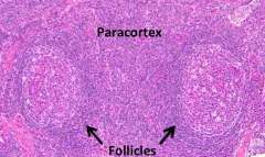 - Paracortex
- Follicular structures