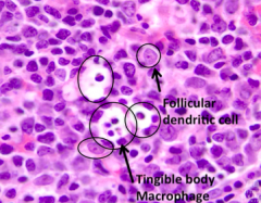 Follicular Dendritic Cells