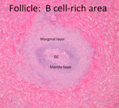 - Germinal Center (GC) - central portion of follicle
- Mantle Layer - zone around GC, dark blue
- Marginal Layer - zone peripheral to mantle zone, outermost layer of follicle