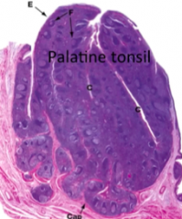 - Look likes a LN at this power
- Contains follicles w/ germinal centres and mantle zones