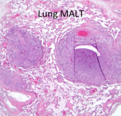 - Alveolar spaces
- Respiratory epithelium
- Bronchiole epithelium

* MALT is found right under basement membrane of epithelium