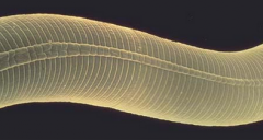 What structure of a nematode is this image showing in detail?