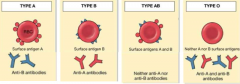 Surface antigen: A and B
Antibodies: Neither anti-A or anti-B