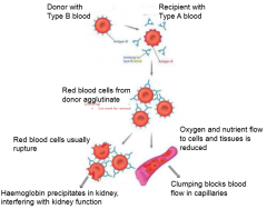 It would bind to B antigen

Cause red blood cells to agglutinate (clump) to mark for removal

Cause either:

1) Rupture leading to haemoglobin precipitating in kidney, interfering with kidney function

2) Oxygen and nutrient flow in cells and tiss...