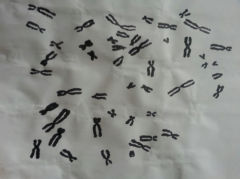 (larger image: http://i.imgur.com/4a1IZUK.png )

The photograph accompanying this question shows the chromosomes from a human cell. Construct and idiogram.

A) is the specimen male or female?
B) what possible kinds of chromosomal abnormalitie...