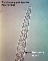 Identify the type of mouth found in the nematode shown (Trichostrongylus) and state what the nematode feeds/is likely to feed on.