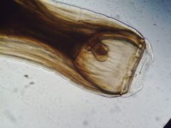 Identify the type of mouth in the nematode shown (Strongylus vulgaris) and state what/how this nematode is likely to feed on?