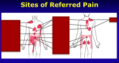 Identify the sites of referred pain:
Liver, SI, appendix, right ureter, heart, stomach, gallbladder, ovary, colon, kidney, bladder