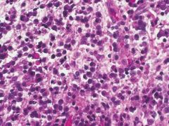 macrophages


lymphocytes


plasma cells