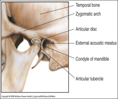 Condylar synovial joint, a fibrocartilaginous disc that cushions the action.
