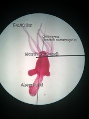 Cnidaria
Hydrozoa 
Hydra
Polyp
 
Tentacles
Mouth (oral end)
Aboral end
Cnidocytes/nematocysts