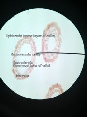 Cnidaria
Hydrozoa
Hydra
Polyp (xs)
 
Epidermis
Gastrovascular cavity
Gastrodermis
Mesoglea