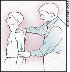 - Relax arm at side and grasp forearm
- Apply downward force while observing joint

Sulcus seen = positive
- Indicates glenohumeral (GH) joint instability