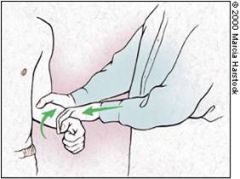 Forearm supination
- Flex the elbow to 90 degree, and pronate hand
- Provide resistance as patient supinates the hand

Pain and clicking = positive biceps tendon injury