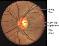 a) fovea
b) pupil
c) lens
d) optic discs
*blood vessels cross the retina but the brain tells it to ignore it*