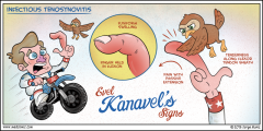 Kanavel's signs 