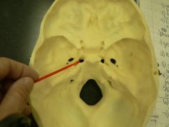 Opening for internal carotid artery to pass into cranial cavity