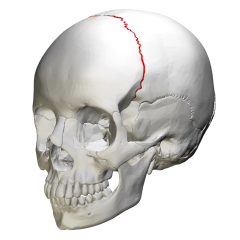 Parietal bone w frontal bone