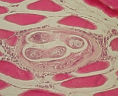 What is the species of the nematode L1 shown encysted in muscle here
