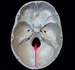 large opening in the base of occipital