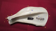 Name the bone (include view [medial/lateral] and orientation [left/right])