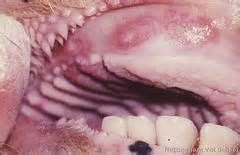 These blisters are seen on the gums, roof of mouth and esophagus. 

What disease is this?
What change histologically causes these lesions?