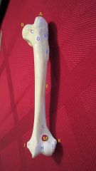 Name the bone (include view [cranial/caudal] and orientation [left/right])
