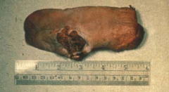 The carcinoma seen here is most likely a what?

This is most commonly seen in what species of animal?
