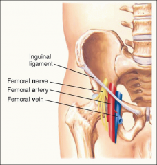 With the patient supine, ask the patient to place the heel of the leg being examined on the opposite knee. 

Palpate along the inguinal ligament
- Femoral nerve, artery, and vein (NAVEL) bisect the overlying inguinal ligament; lymph nodes lie m...