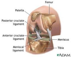 Medial Collateral
Lateral Collateral
Anterior Cruciate
Posterior Cruciate