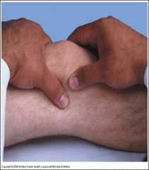 Place thumb and index finger of right hand on each side of the patella
- With left hand, compress the suprapatellar pouch against the femur. 

Feel for fluid entering (or ballooning into) the spaces next to the patella under your right thumb an...