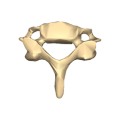 What vertebrae is this?


how can you tell?