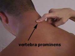 what level is the vertebral prominens?
