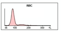 The RBC histogram below is indicative of: