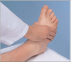 Compress the forefoot
- tenderness is an early sign of RA