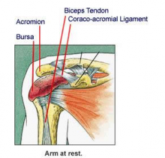 bursitis shoulder 
why and how painful comes?
